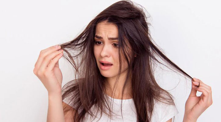 Hair Fall In Winter Follow These Tips To Control It 5056