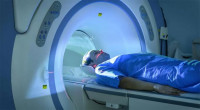 Long Covid: MRI scans reveal new clues to symptoms