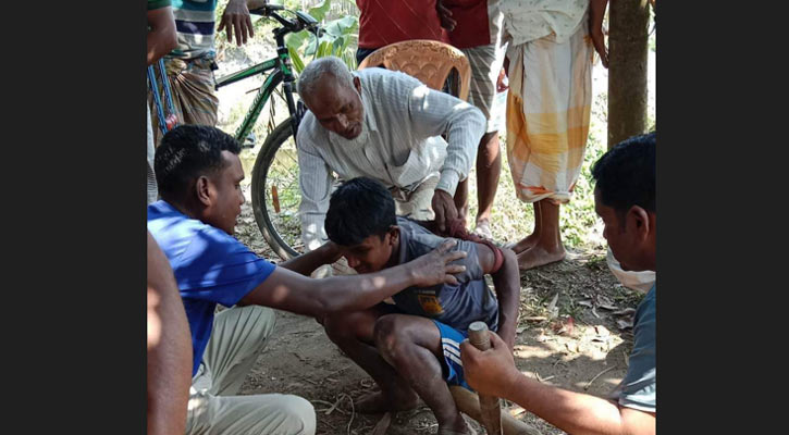 চোর সন্দেহে কিশোরকে মধ্যযুগীয় কায়দায় নির্যাতন