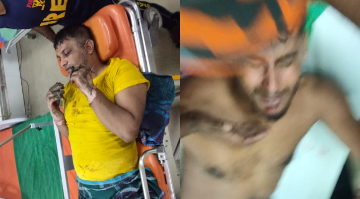 টঙ্গীর কেমিক্যাল গোডাউনে লাগা আগুন নিয়ন্ত্রণে, আহত ৪